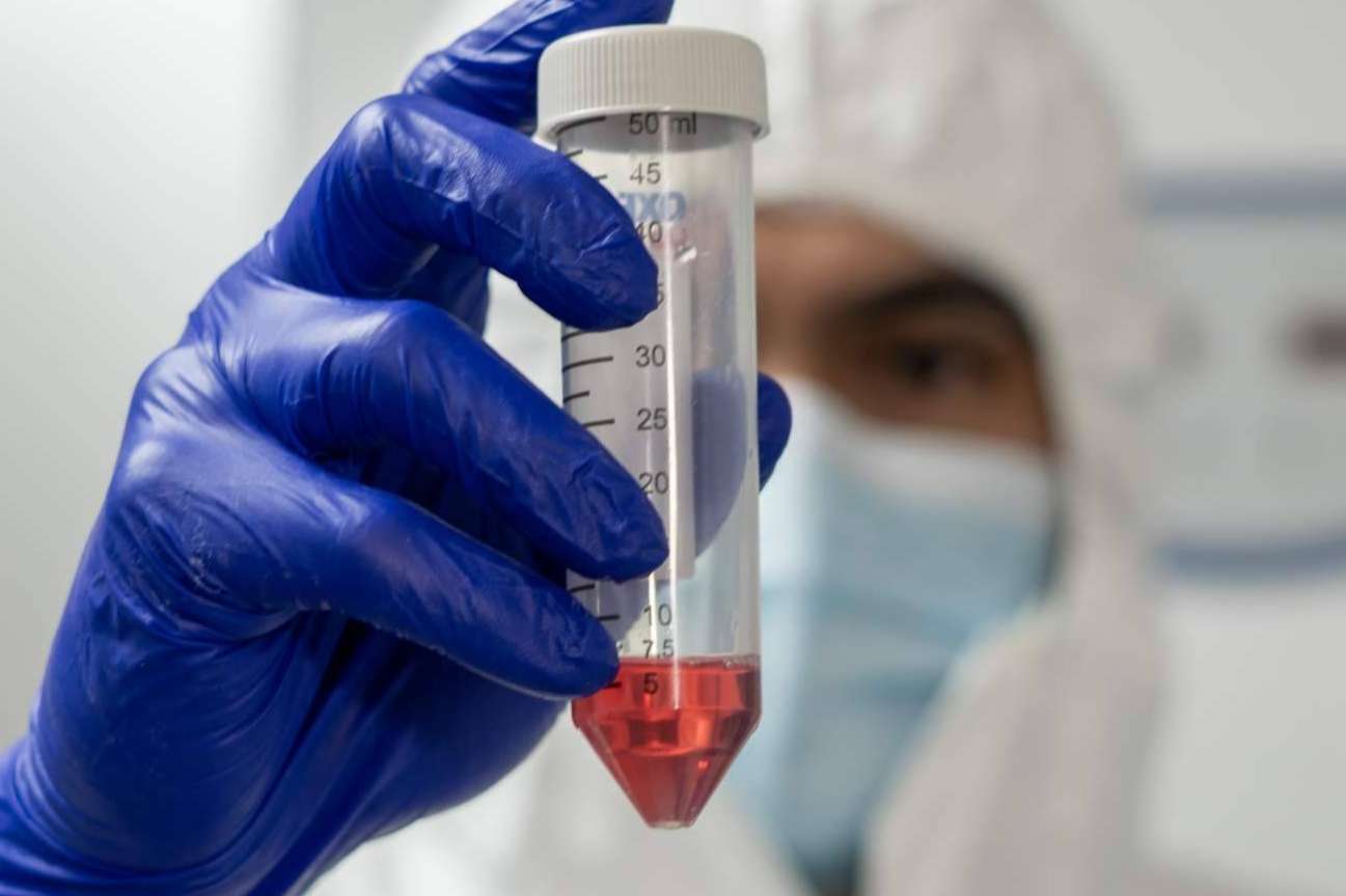 La nueva biotecnología para pacientes con cáncer en etapa 3 y 4; Inmunoterapia personalizada DEXs de Oncovix