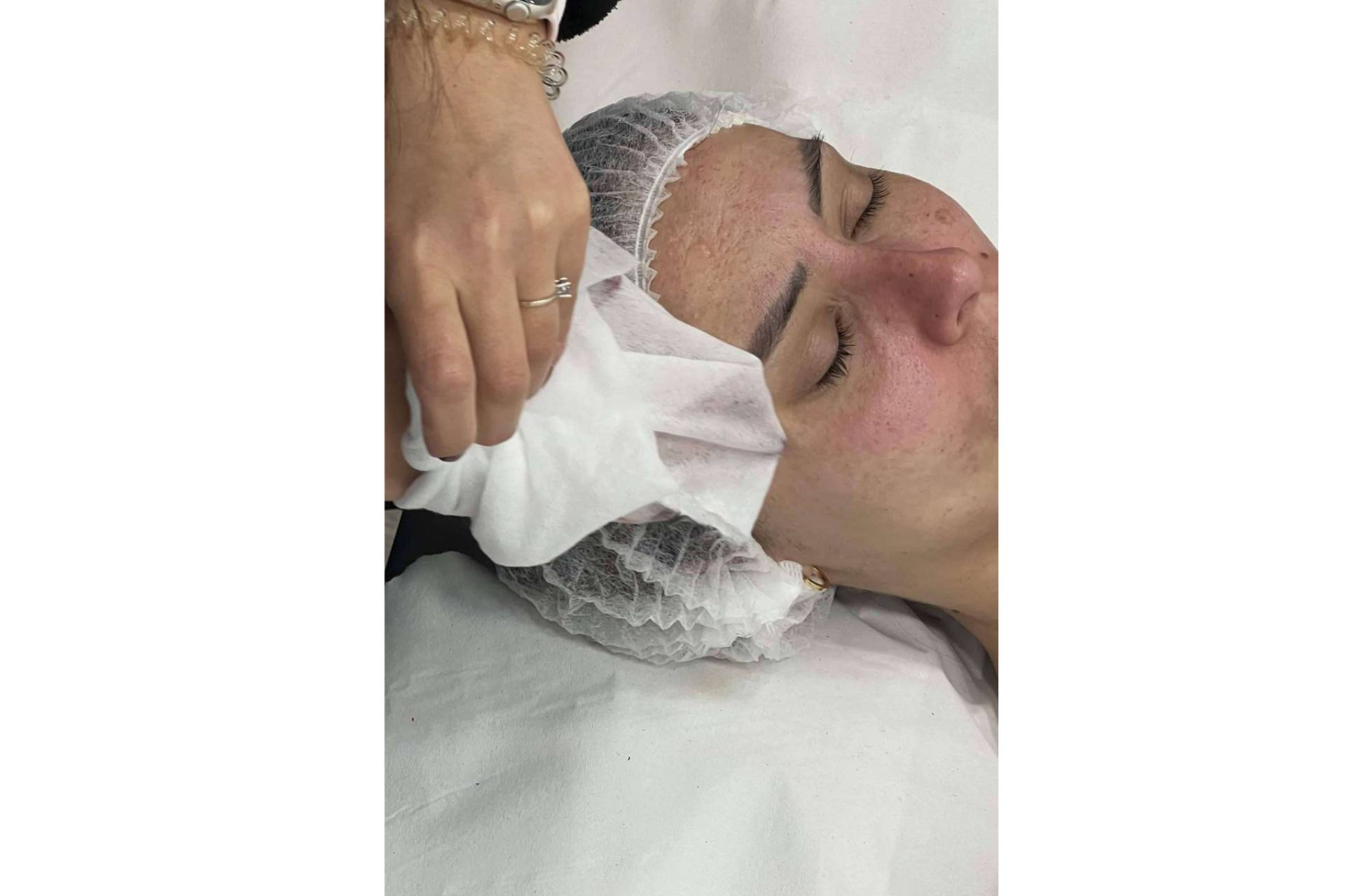 Tratamientos para la vuelta a la rutina personalizados de 360 Clinics