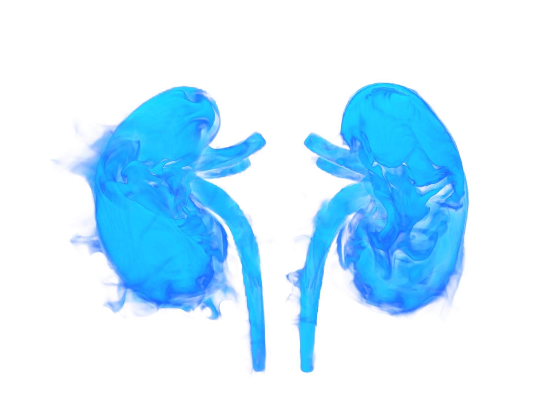 Cómo la hidronefrosis puede afectar la salud renal de los niños